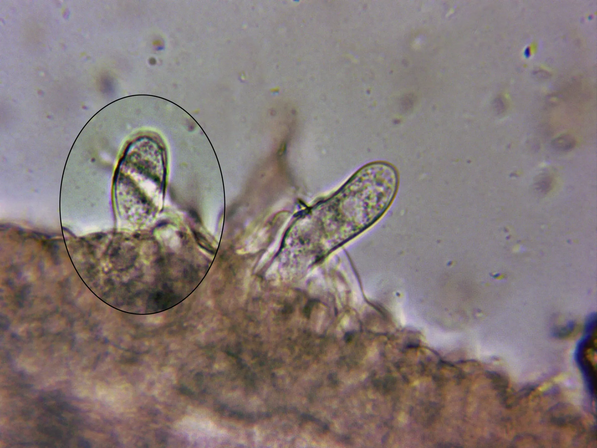 Microscopía de Lactarius acerrimus - 5 Queilocistidio